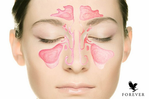 سینوزیت چیست؟