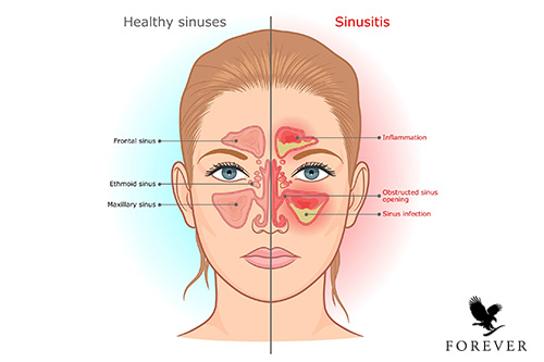 محصولات مناسب برای بهبود علائم سینوزیت
